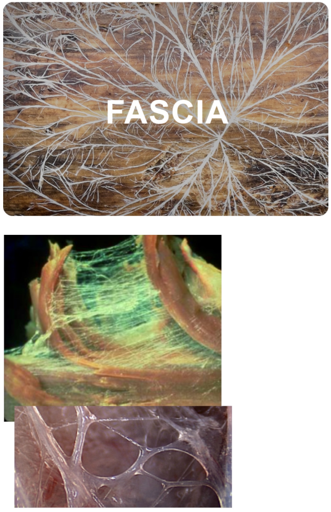 Myofascial Release Massage! Recharge Therapeutic Massage & Wellness Studio